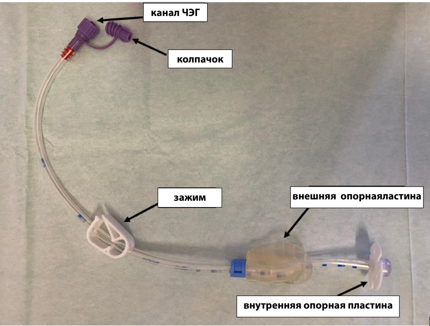 Рисунок 1. Энтеральный зонд для питания с опорной пластиной (ЧЭГ).