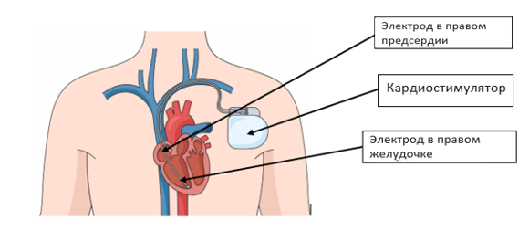 A diagram of a human body</p>
<p>Description automatically generated