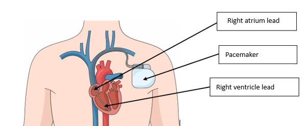 A diagram of a human body</p>
<p>Description automatically generated