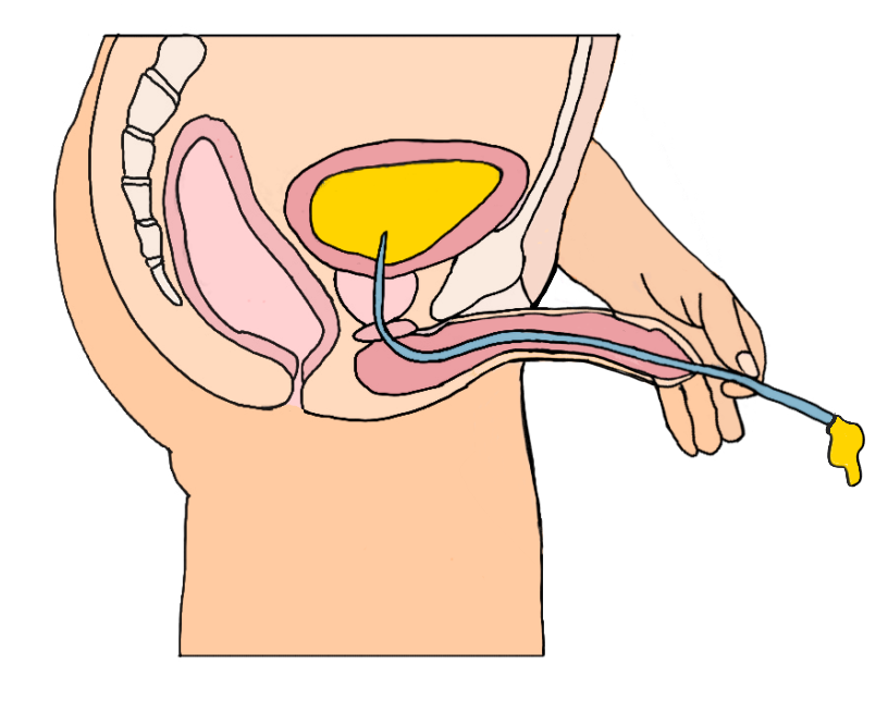 A diagram of a person's uterus</p>
<p>Description automatically generated