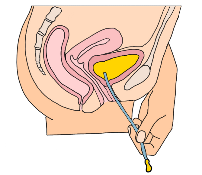 A close-up of a uterus</p>
<p>Description automatically generated