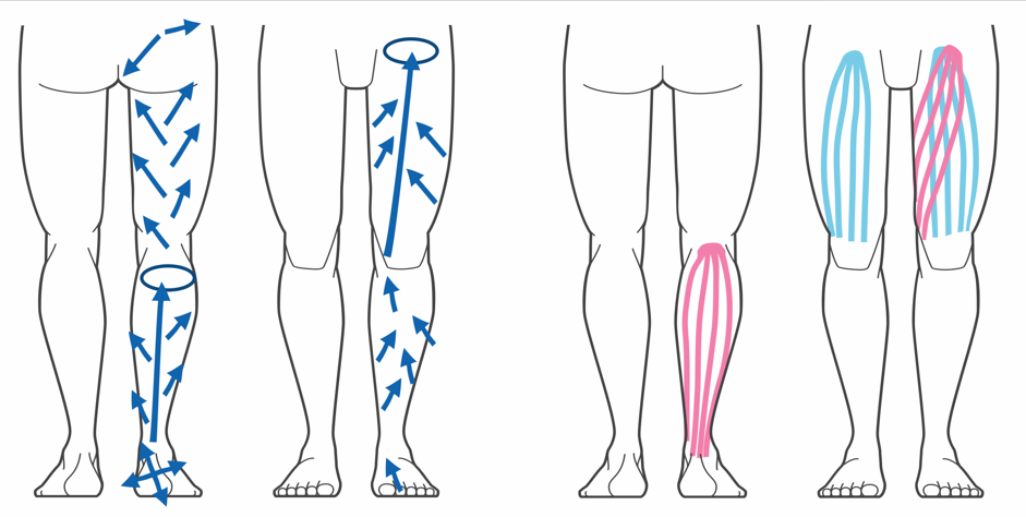 A diagram of a person's legs Description automatically generated