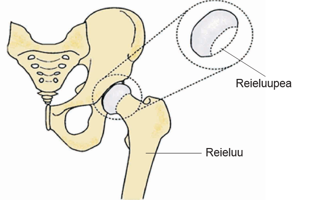 A diagram of a hip bone</p>
<p>AI-generated content may be incorrect.