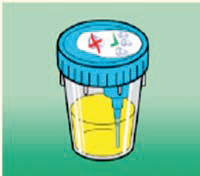 Figure 2. Protective sticker of the sample cup